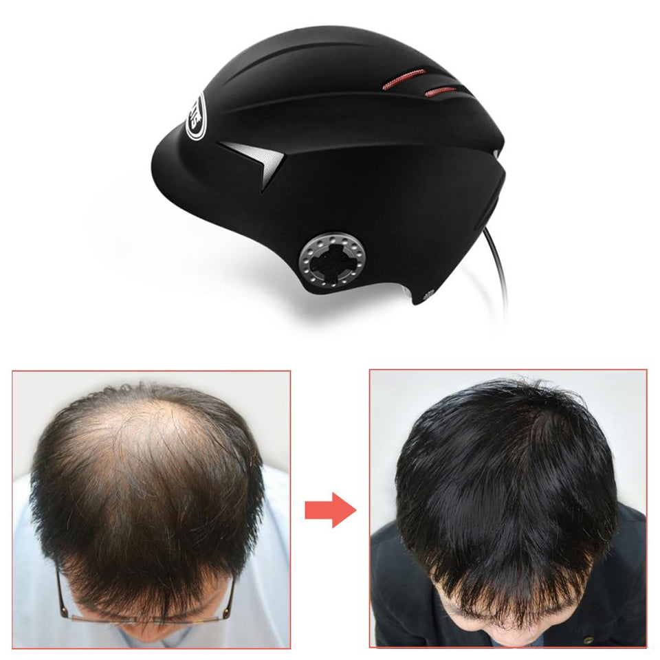 64/128 Medical Diodes Laser Hair Growth Helmet Hair Fast Regrowth LLLT Laser Cap