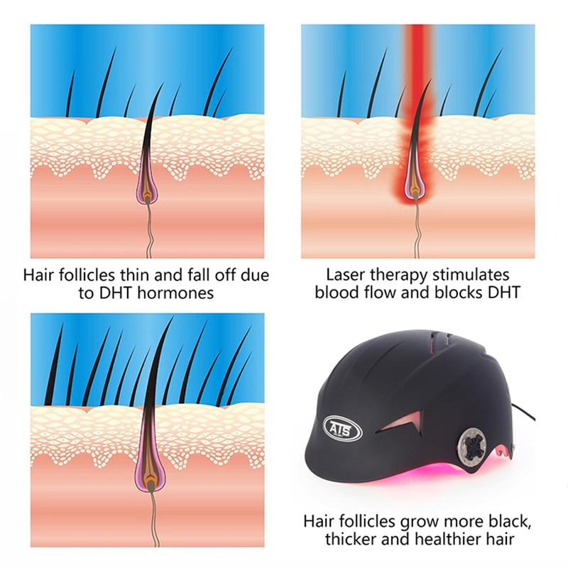 64/128 Medical Diodes Laser Hair Growth Helmet Hair Fast Regrowth LLLT Laser Cap
