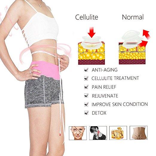6 Pcs Anti Cellulite Vacuum Cups Silicone Massage Cupping Set for Home Use
