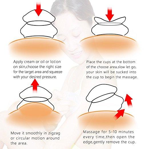 6 Pcs Anti Cellulite Vacuum Cups Silicone Massage Cupping Set for Home Use