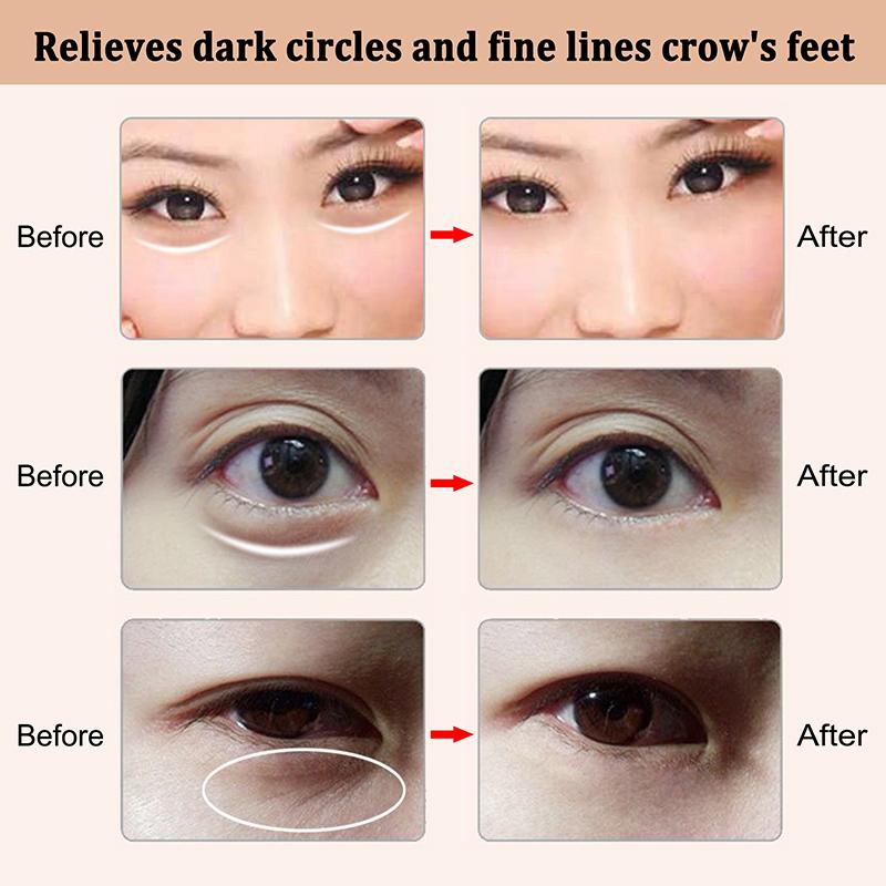 Galvanic Eyes Wrinkle Removal Eye Massager