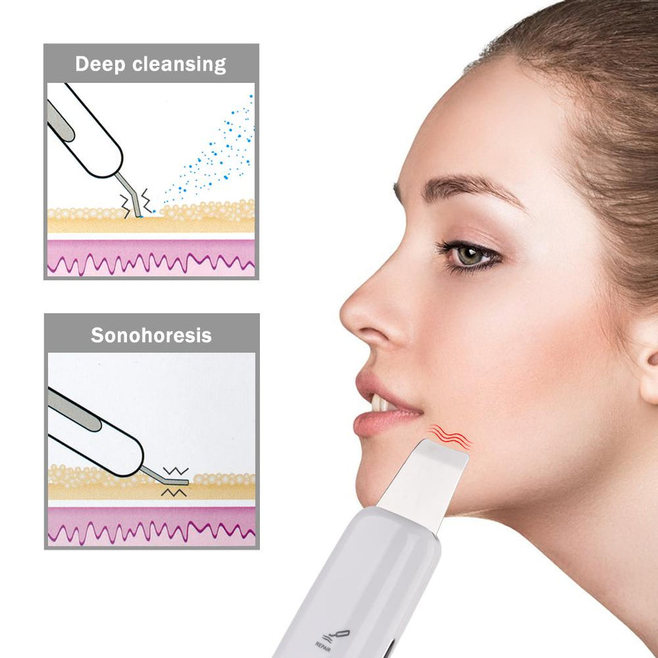 WONDER Ultrasonic Ion High Frequency Skin Scrubber Face Peeling Face Massager