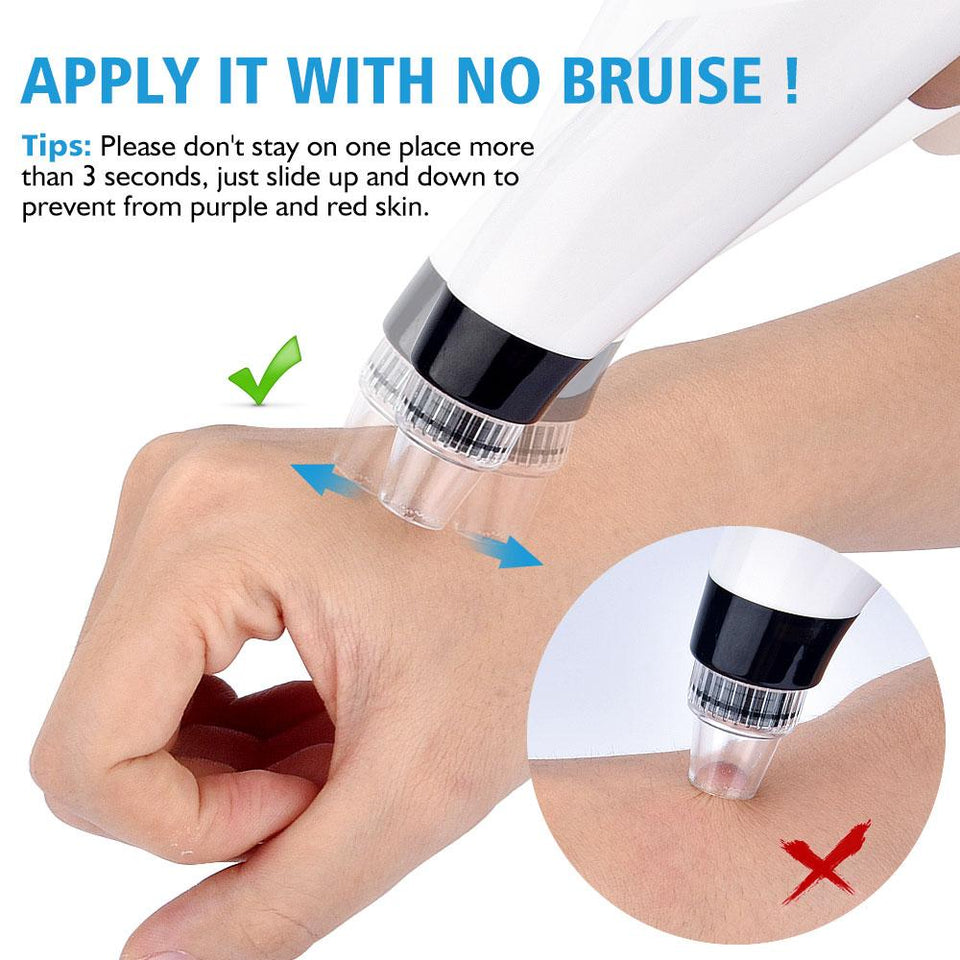 5 Levels 5 Heads Vacuum Blackhead Acne Removal Suction Machine with Led Light