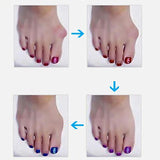 1 Pair Bunion Splint Big Toe Corrector Hallux Valgus Straightener