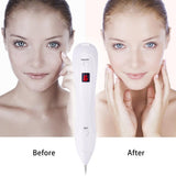 Upgraded 6 Levels Mole Freckle Spots Removal Pen Spot Eraser Pen with LCD Display