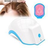 Laser Therapy Hair Growth Helmet Device Anti Hair Loss Cap