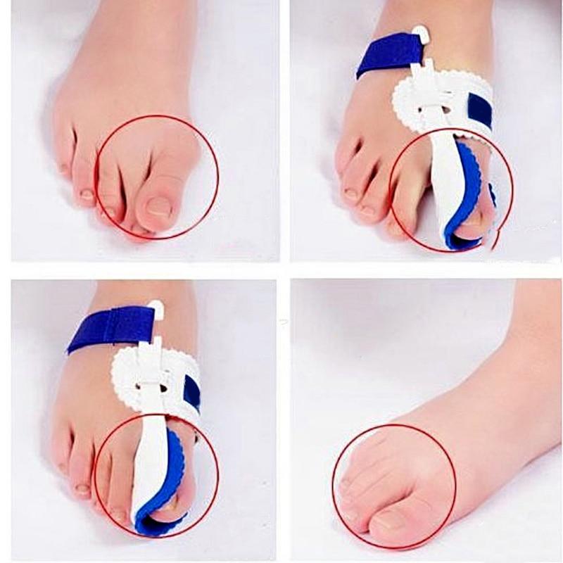 Bunion Device Hallux Valgus Orthopedic Braces Toe Corrector
