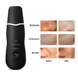 3 Modes Rechargeable Ultrasonic Scrubber Facial Spatula Cleaner
