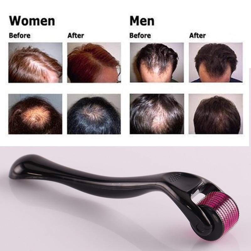 0.25-2.0mm 540 Titanium Hair Care Derma Micro-needling Roller