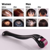0.25-2.0mm 540 Titanium Hair Care Derma Micro-needling Roller
