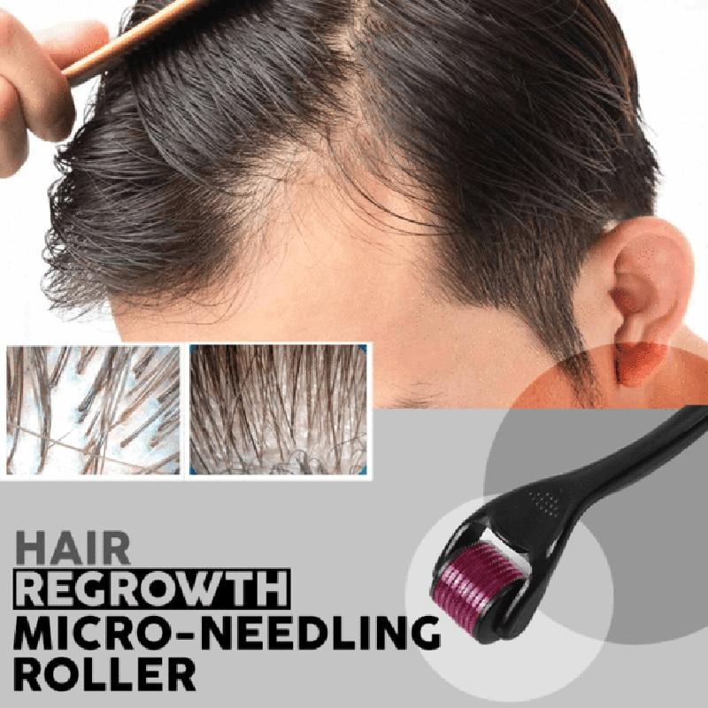 0.25-2.0mm 540 Titanium Hair Care Derma Micro-needling Roller