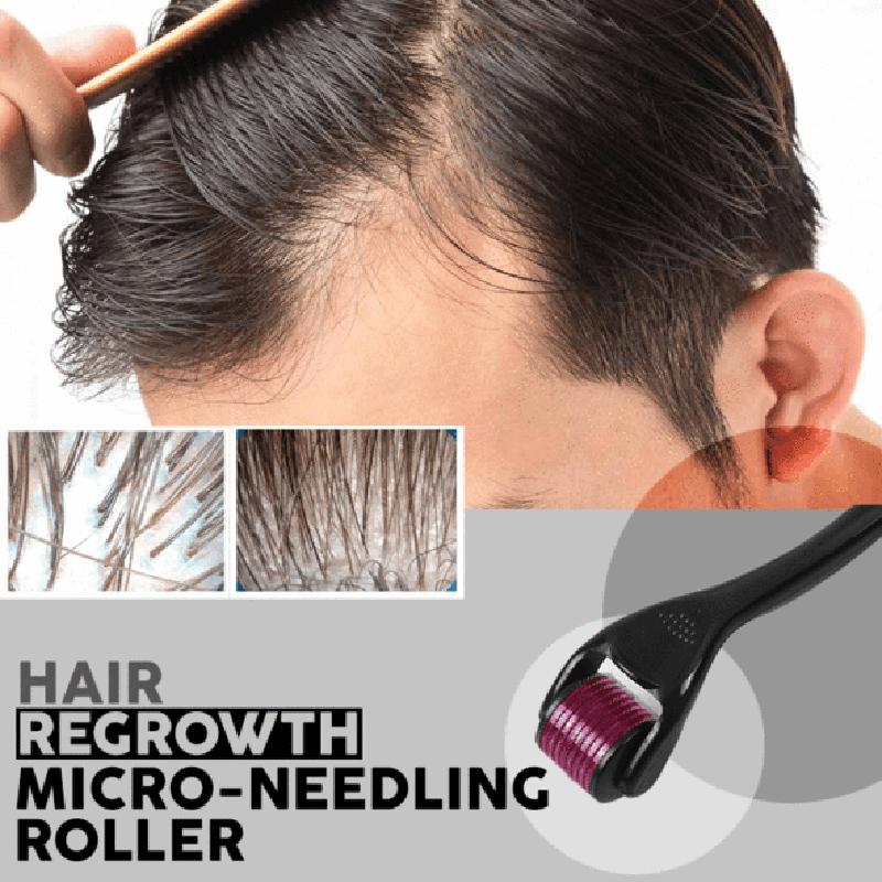 0.25-2.0mm 540 Titanium Hair Care Derma Micro-needling Roller