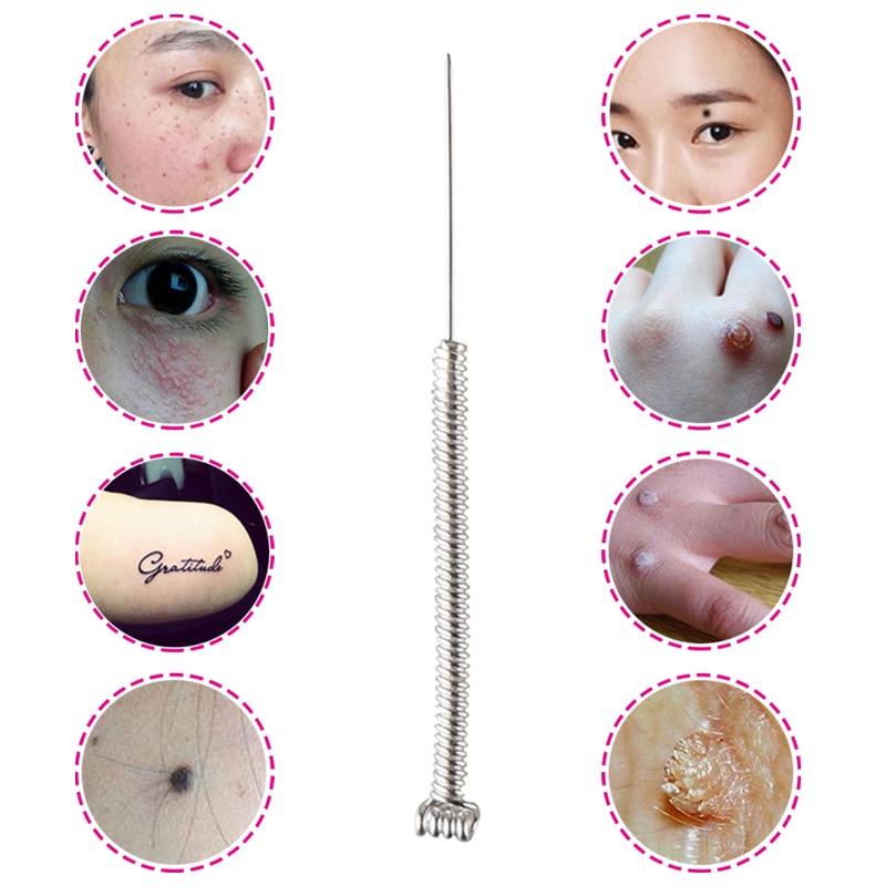 50/ 100 Pcs Plasma Pen Needles For Laser Skin Dark Spot Remover Mole Tattoo Removal Pen